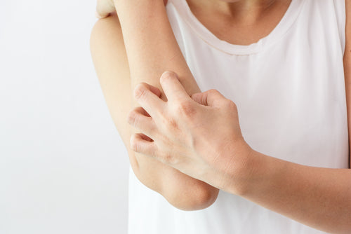 What is eczema?
